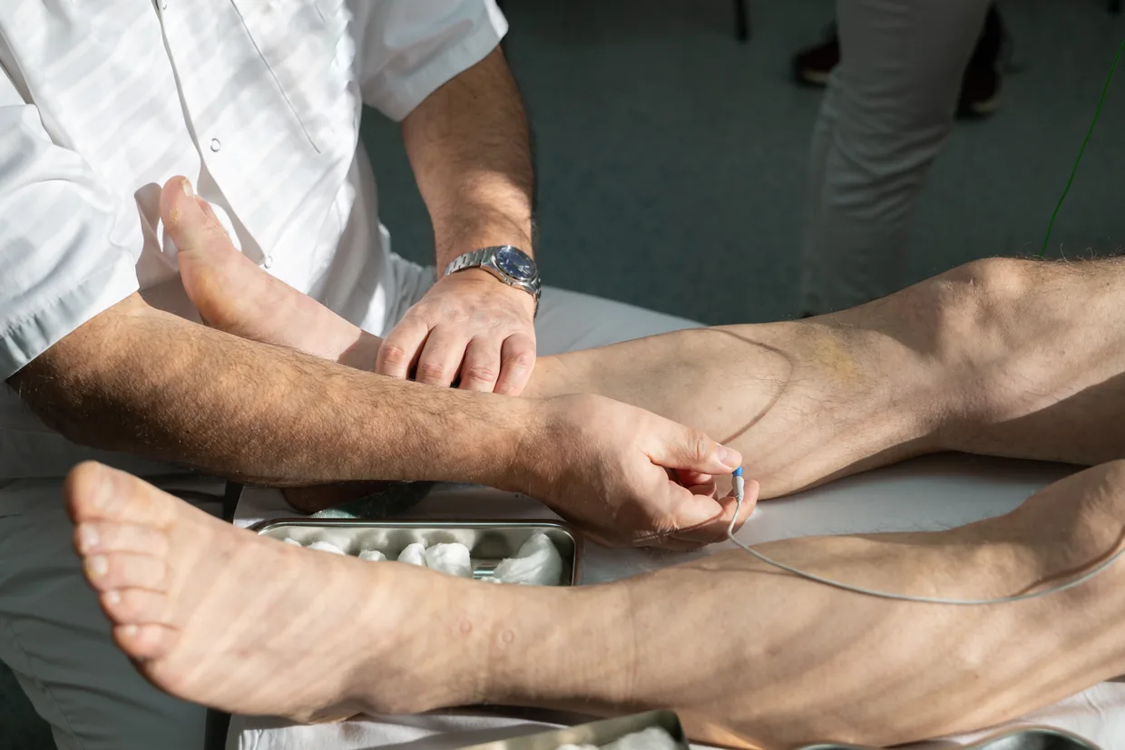 A vein specialist mapping a patient leg before treatment