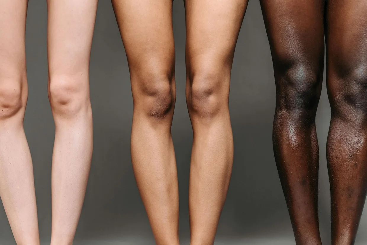 Three pairs of legs of different skin tones, side by side
